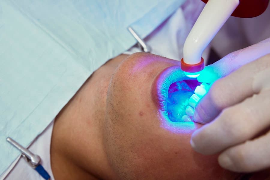 Laser Treatment