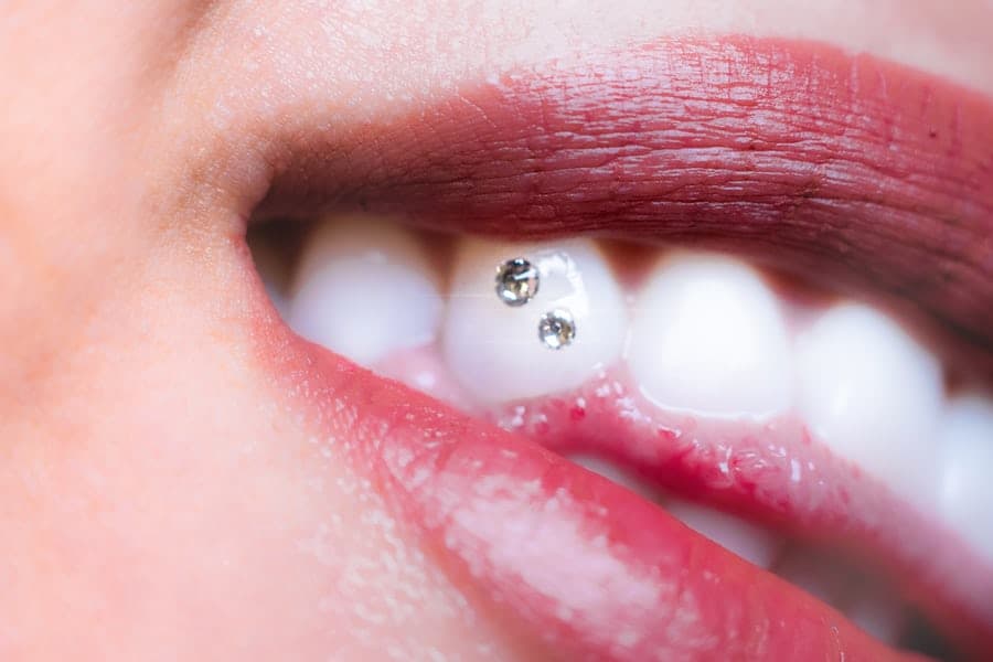 Tooth Jewel