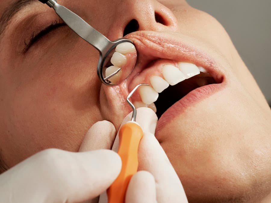 Tooth Removal